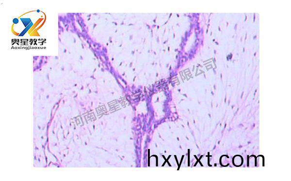 乳腺(xian)纖(xian)維(wei)腺(xian)癅