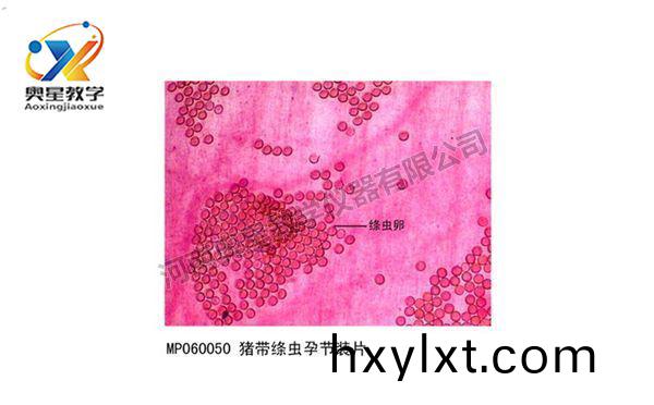 豬(zhu)帶縧(tao)蟲(chong)孕(yun)節