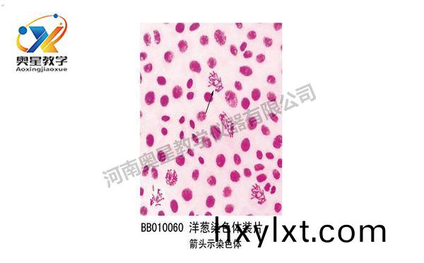 洋蔥(cong)染(ran)色體(ti)