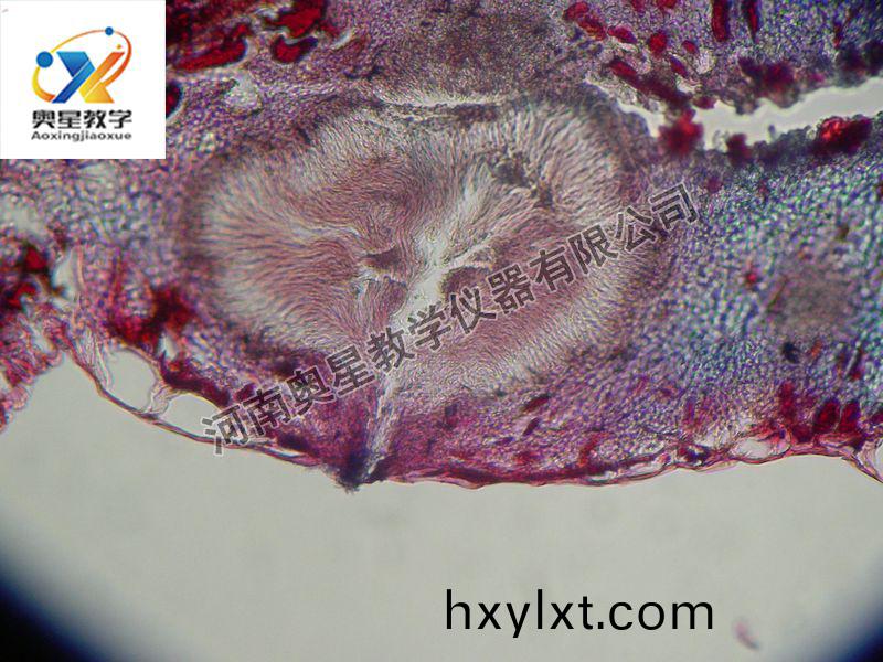 杏(xing)疔(ding)菌